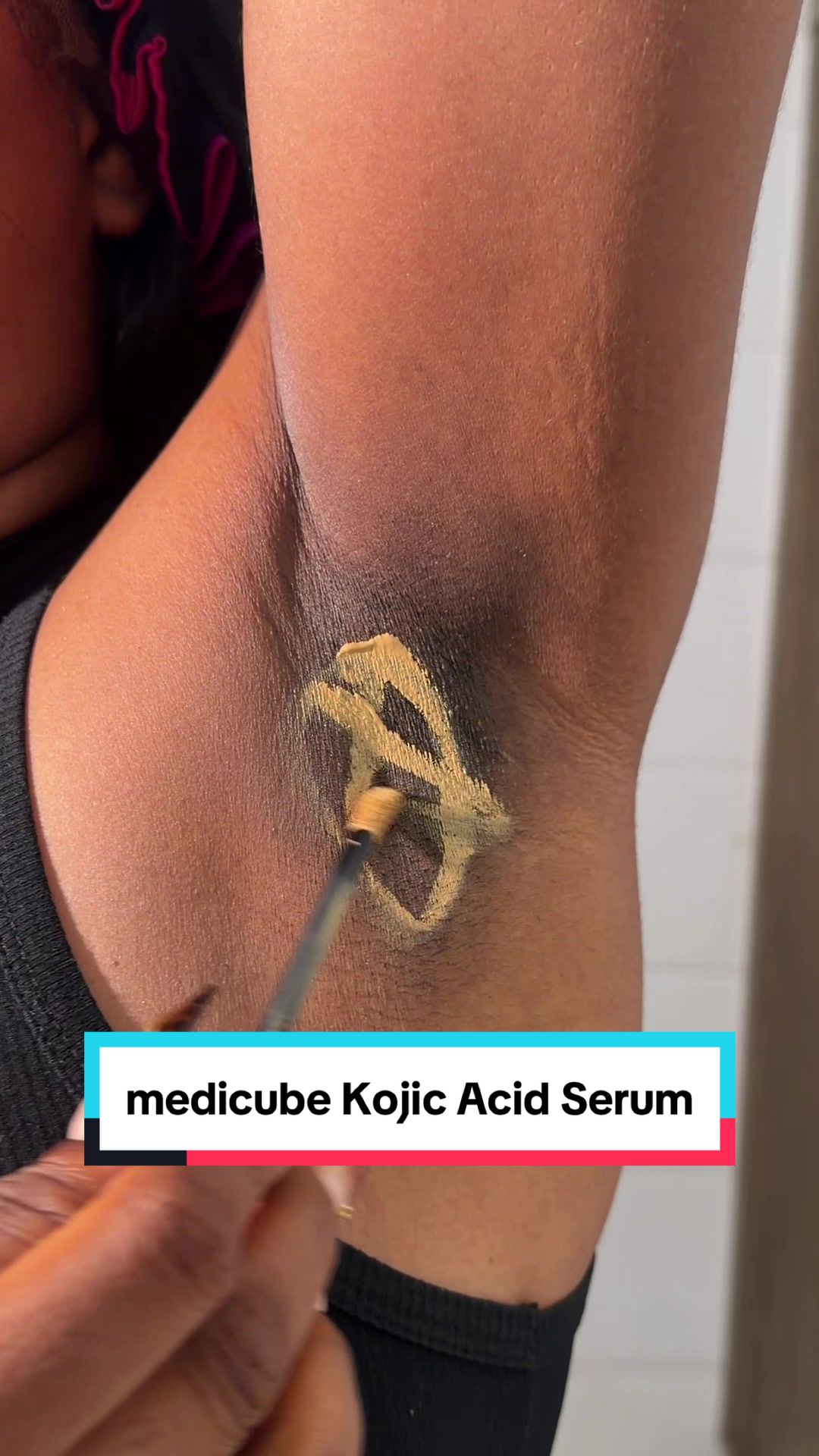 Kojic Acid + Turmeric